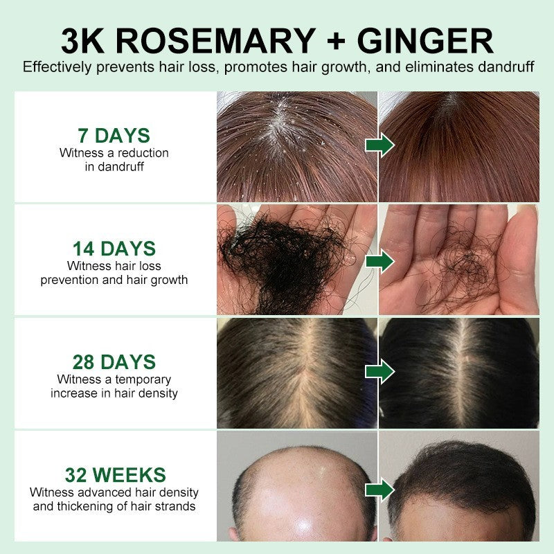 Rosemary Oil Hair Growth For Men Women Ginger Hair Loss Fast Regrowth Thicken Scalp Oils Treatment Hair Treatment